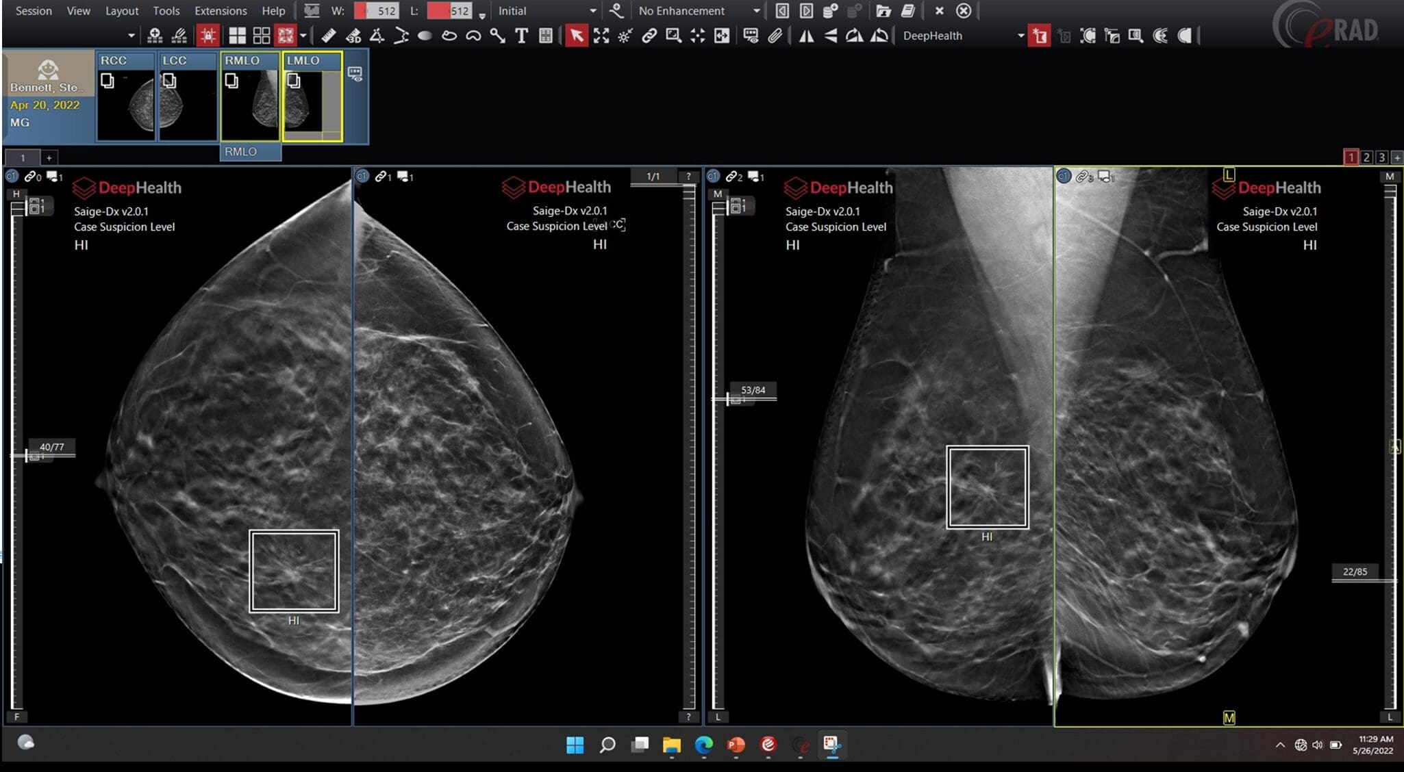Featured image for “Advances in mammography among Breast Cancer Update topics”